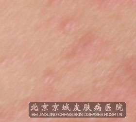 õ忷Щ