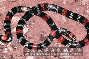 ҧЩʩ
