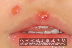 ŧ崯ƵĴʩʲô