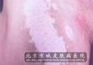 ļ𼲲