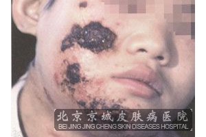 ŧ崯ȷ