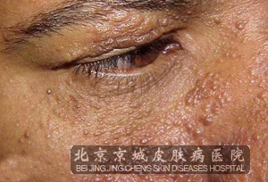 Ӳ֢ĳ仯