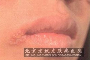 ԤķҪô