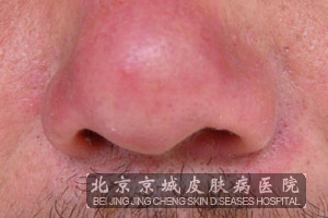 ����ǵķ����ص����