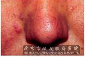 ����ǻ�����ʳ�Ļ�����ʩ��ʲô