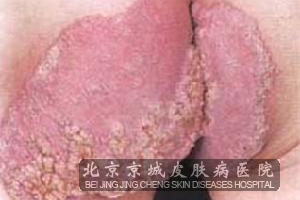 ԸƤʲô֢״