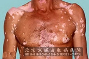 ֹ縴