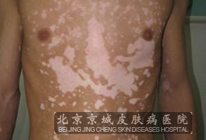 综Ӧʳʲô