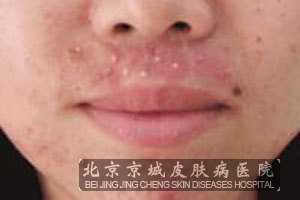 �°ͳ��ഺ��������ʲô�����