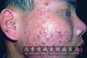 ��Щ���ؿ��Ե����ഺ����