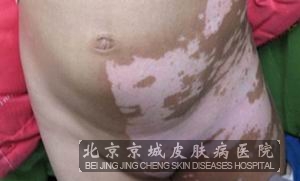 综ߵʳʲô