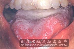 ĲЩ