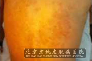 Ⱦิô
