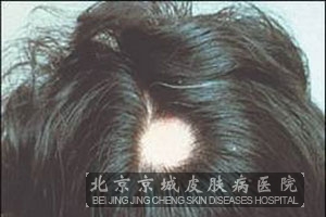 ưͺһ㷽