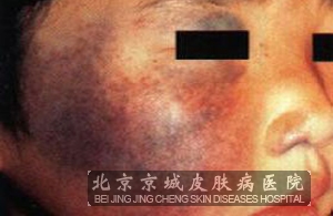 õ忷Щ