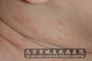 Ԥӵһ㷽