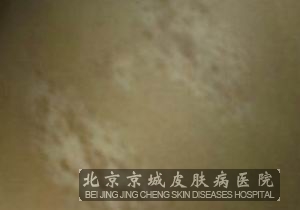 综Ҫעʲô