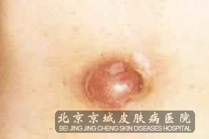 沿Ӹ֢״ʲô