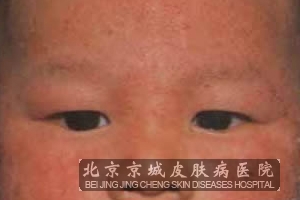 ӤʪעЩ