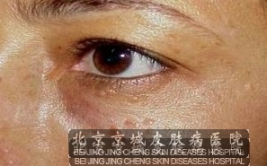 ʲô֢״