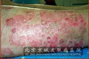 ����Ƥ��Ӧ����λ���