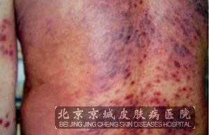 ����Ƥ����ʲô�ٴ�����