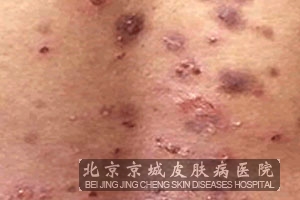 ��������������Щ���Ƶķ���