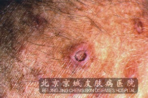 ����������Ĵ�����ʩ��ʲô