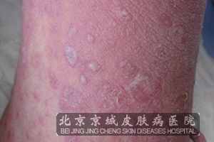 ��м�����ص�ԭ����ʲô