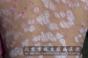 ��м�����շ�ԭ����ʲô