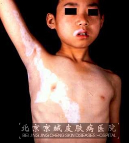 综ͼƬ
