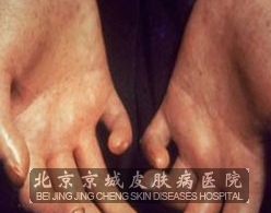 ӲƤӦô