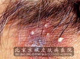 ��ë���ײ��ܳ���Щʳ��