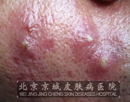 ���沿ë���׸��������