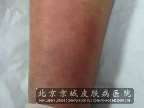 �����ķ�������Щ�����й�