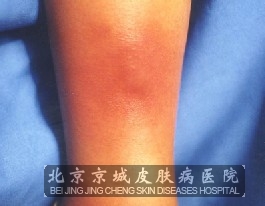 ������֢״�������Ʒ���