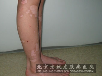 绤ͼƬ