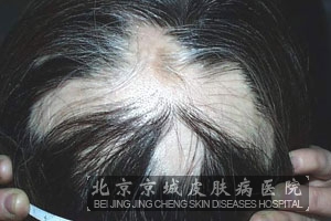 ŴѷЩ