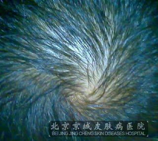 ļͷҪʲô