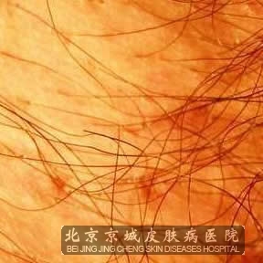 ͷʭصЩ