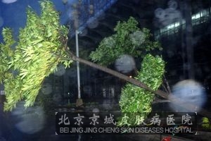 ������ݡ�����֢״������ʲô