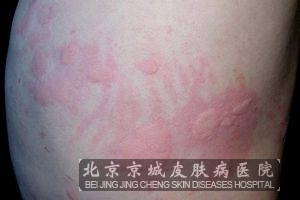 ������ݡ����ᴫȾ��