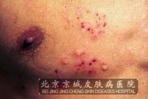 ������ݡ��������Ԥ��