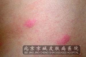 ������ݡ�����֢״������ʲô