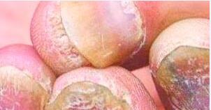 ���˻�ָ�׺�����