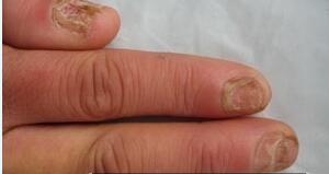 ���˻�ָ�׿��� ��