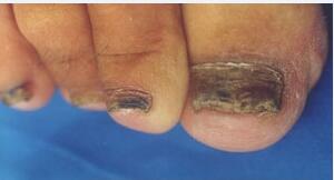 ��ô��ָ������ô�������