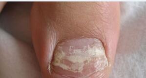 ����ȥ����ָ�׼���