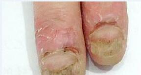 ��ô�����ƻ�ָ�ײ�