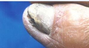 ��ָ����ô��Ⱦ����